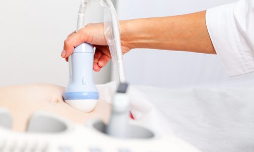 Close-up shot of sonographer scanning young pregnant woman's belly with ultrasonic transducer doing obstetric ultrasonography